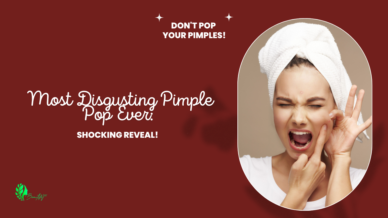 Most Disgusting Pimple Pop Ever: Shocking Reveal!