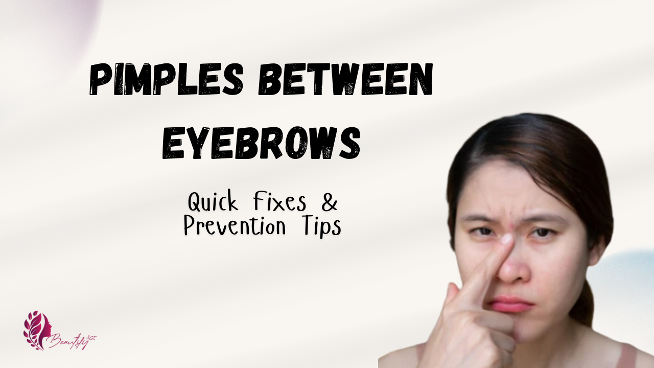 Pimples Between Eyebrows - Quick Fixes & Prevention Tips